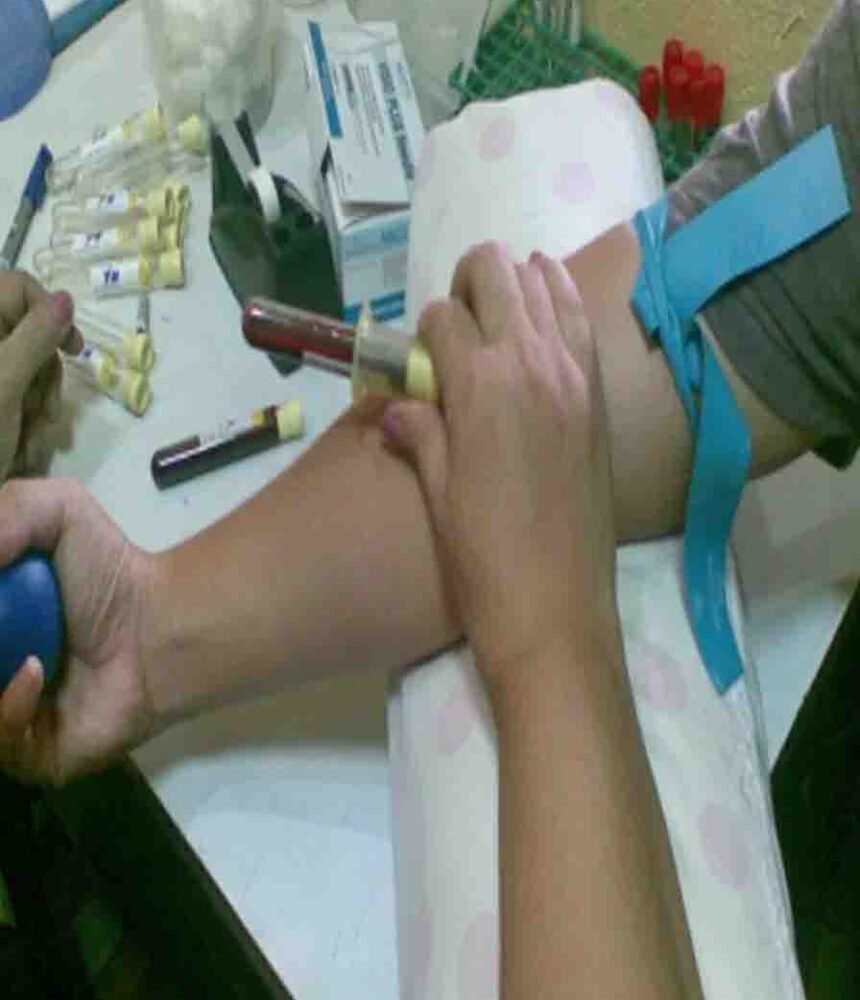 Lymphocyte Immunization Therapy
